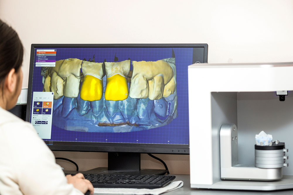 5 things to consider when choosing dental practice software